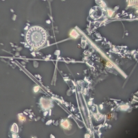 Diatomeen im Mikroskop